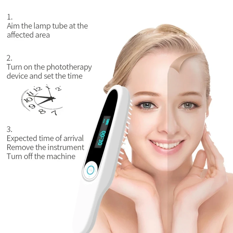 Ultraviolet UV Beauty Instrument UVB Lamp Is Used For Skin Care To Make The Skin Moisturized And Elastic EU Plug