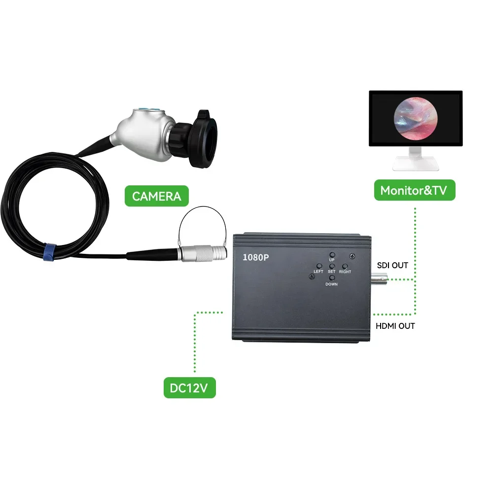 

FHD Portable Medical Endoscopic Camera for Otolaryngology Surgery,1080p1/1.8 CMOS rigid endoscopic surgery camera