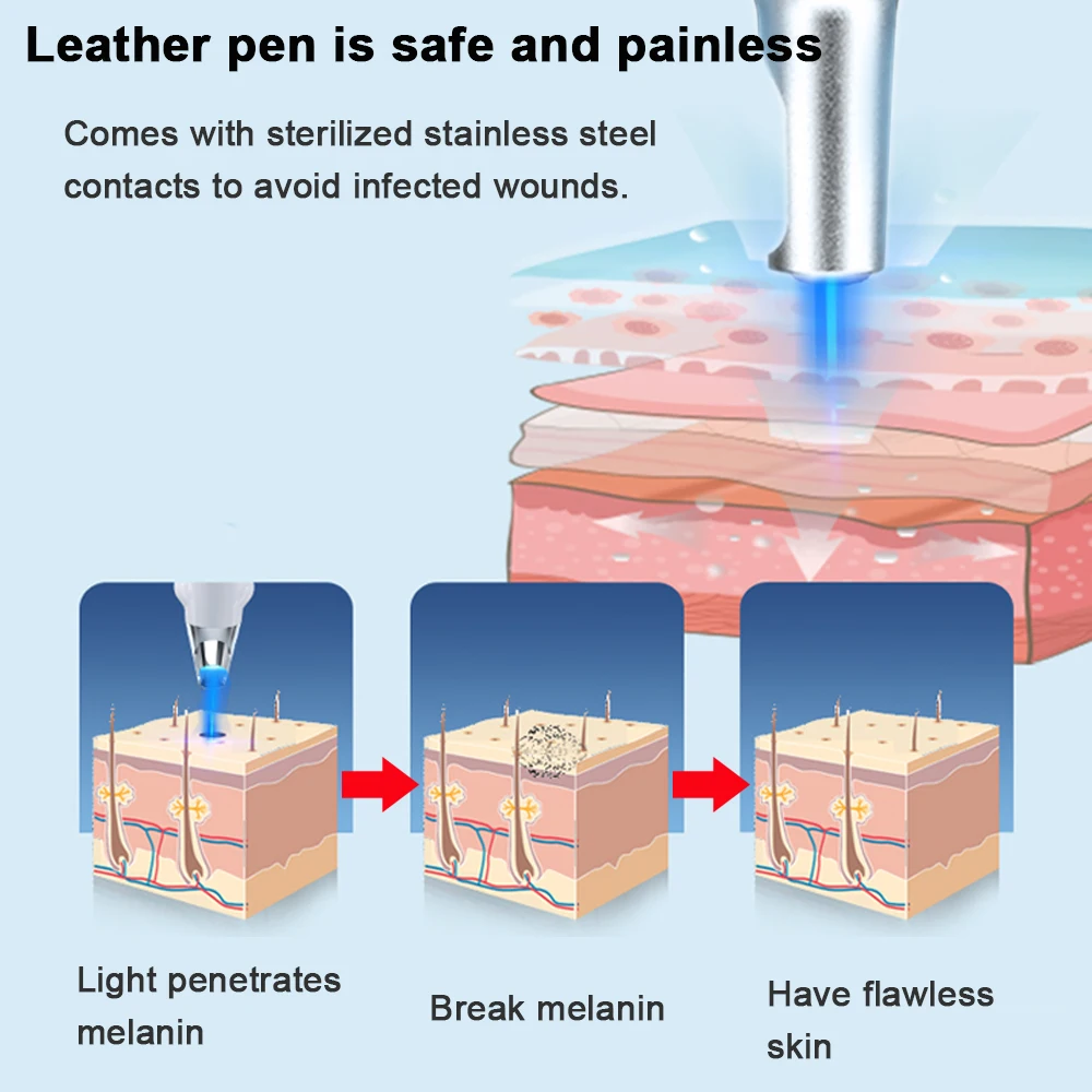 Zaawansowany wskaźnik laserowy pikosekundowy maszyna do usuwania pieprzyków brodawek długopis plazmowy piegów tatuażowych ciemne plamy przybory