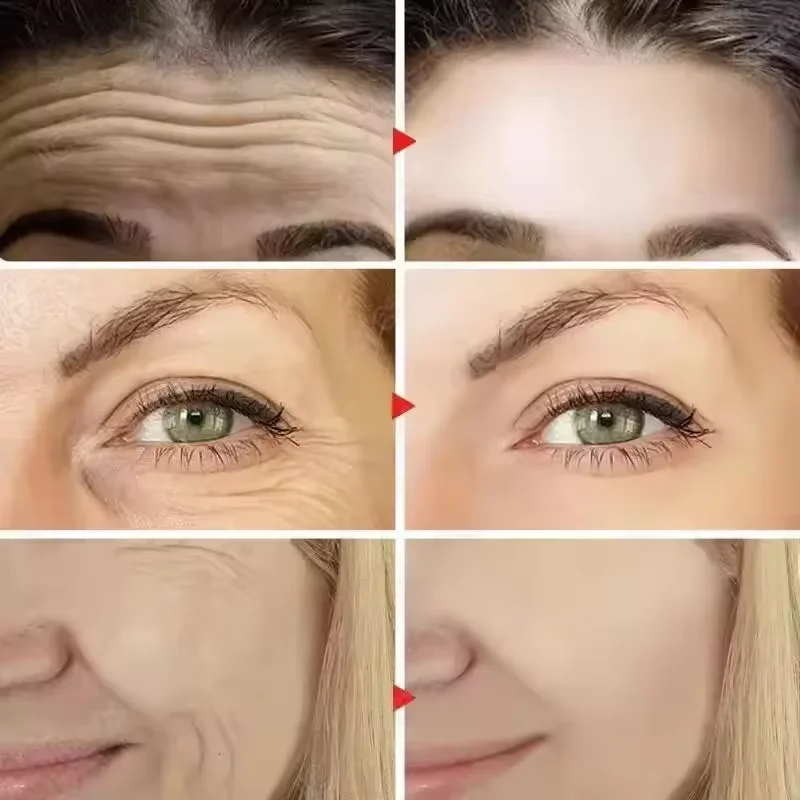 ريتينول كبسولات الوجه مصل إزالة التجاعيد مكافحة الشيخوخة تجديد الوجه ترطيب تبييض منتجات العناية بالبشرة الكورية