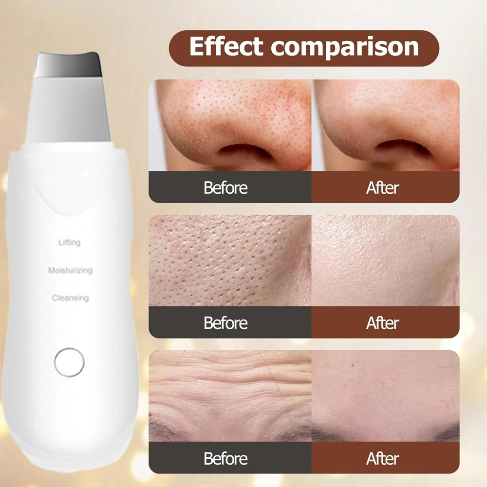 Épurateur de peau électrique à ultrasons, spatule vibrante pour le visage, dissolvant de points noirs, Lifting du visage, nettoyage, soins de la peau à ultrasons