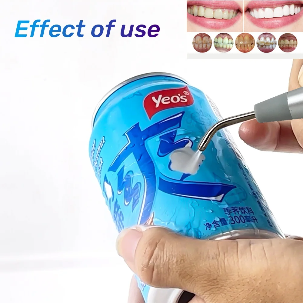 

Dental Air Polisher Sandblaster Machine for Teeth Cleaning Polishing Prophy Jet Piezon Scaler Tips Remove Plaque Tartar Stain