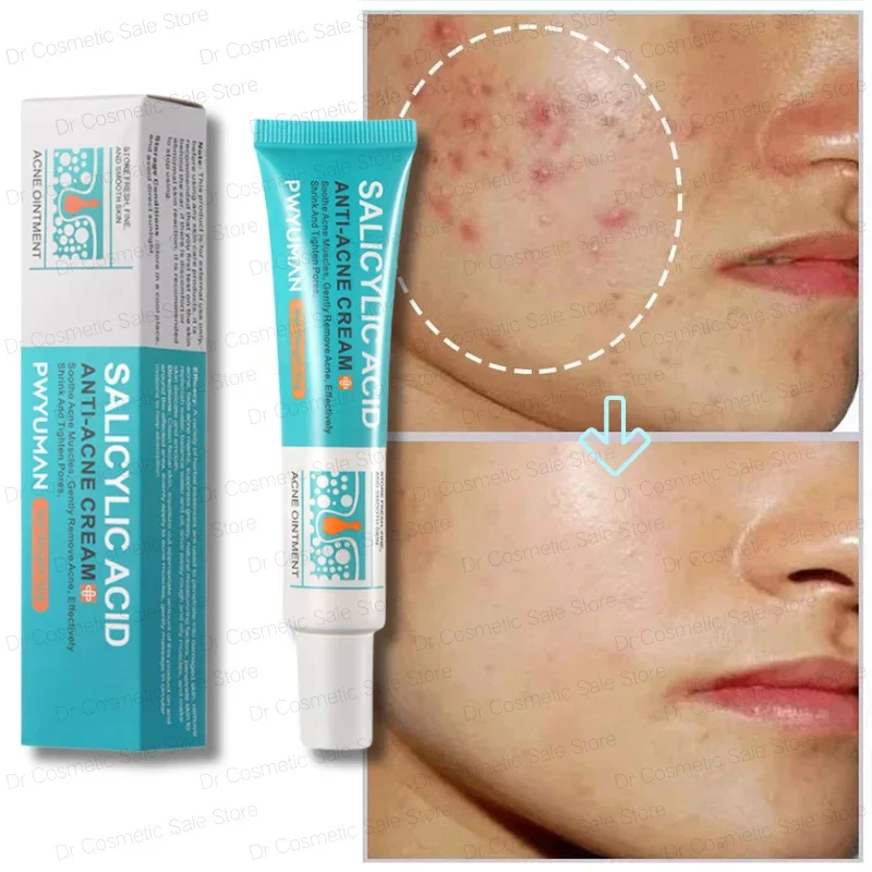 

Effective Acne Removal Cream Anti-Acne Repair Redness Pimple Spots Gel Deep Cleaning Pore Oil Control Moisturizing Skin Care 30g