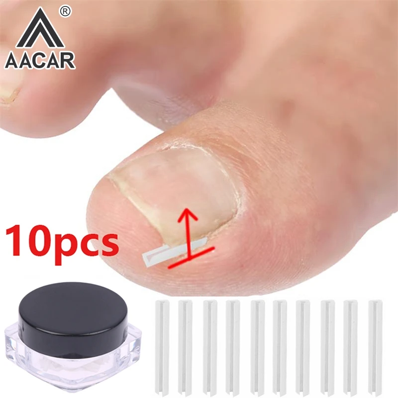 10pc/box Ingrown Toenail Correction Tool Ingrown Toe Nail Treatment Elastic Patch Sticker Straightening Clip Brace Pedicure Tool