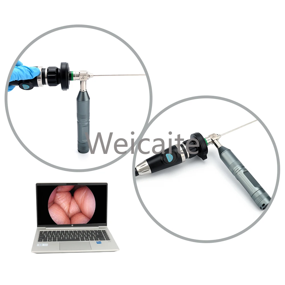 ขายร้อนกล้องส่องกล้องแบบพกพา, USB Endoscope กล้องทางการแพทย์สําหรับแล็ปท็อป, Ent กล้องส่องกล้องส่องกล้องแบบพกพา