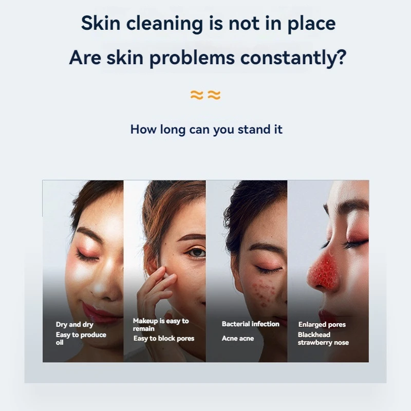 小さな泡の黒ずみ分析装置、毛穴の洗浄とニキビの除去、クレンジング、酸素注入、水分補給、肌の栄養補給