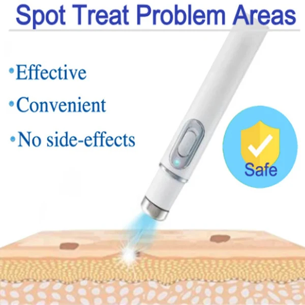 Portable Acne Treatment Pen Activates The Skin & Tightens Loose Skin for Oily Skin & Heavy Sensitive Skin