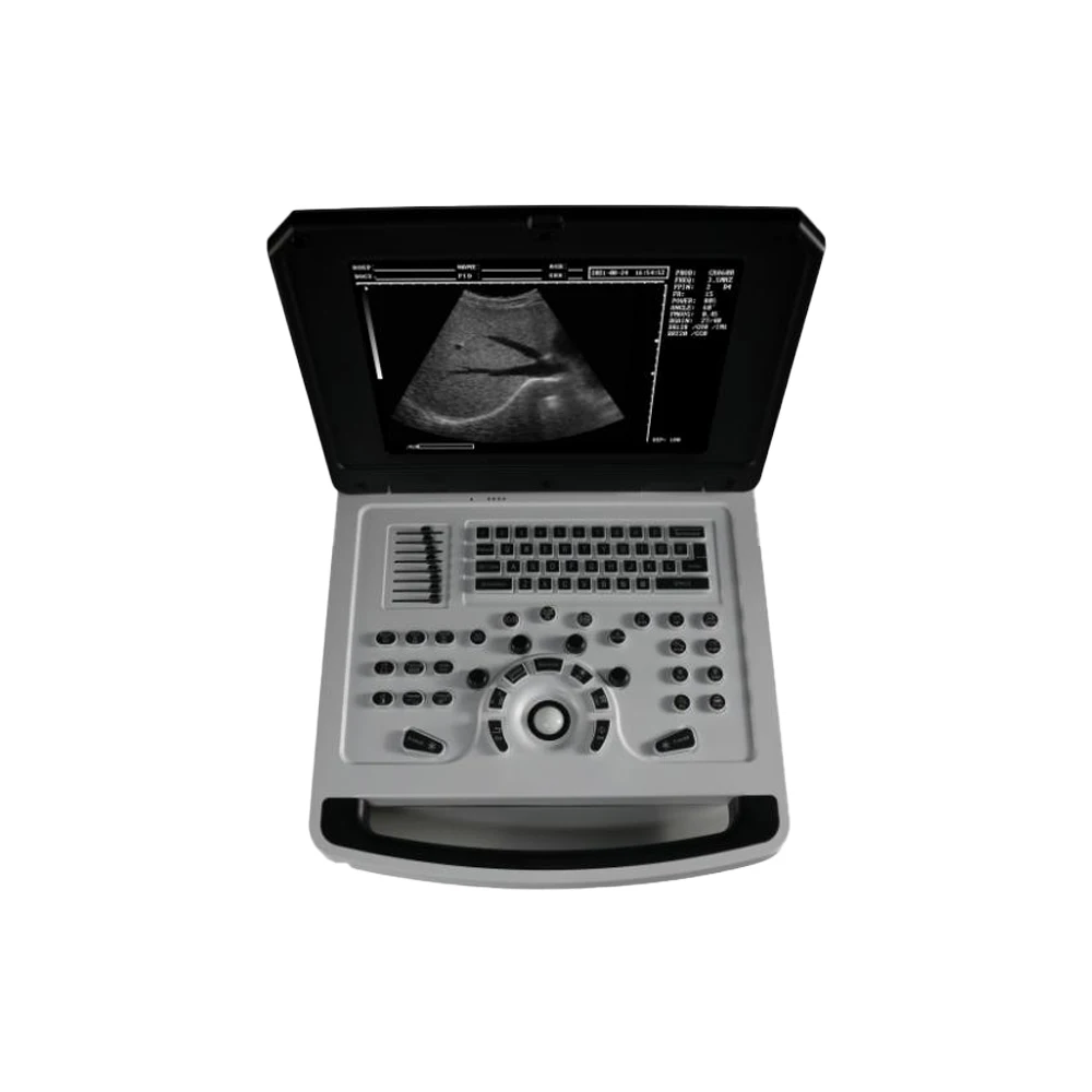 Π§/Π ΡΠ»ΡΡΡΠ°Π·Π²ΡΠΊΠΎΠ²ΠΎΠΉ ΡΠΊΠ°Π½Π΅Ρ Π΄Π»Ρ Π½ΠΎΡΡΠ±ΡΠΊΠ°, ΡΠΈΡΡΠ΅ΠΌΠ° USG Π΄Π»Ρ ΡΠ΅Π»ΠΎΠ²Π΅ΠΊΠ°/VET, 15-Π΄ΡΠΉΠΌΠΎΠ²ΡΠΉ ΠΏΠΎΡΡΠ°ΡΠΈΠ²Π½ΡΠΉ Π»ΠΈΠ½Π΅ΠΉΠ½ΡΠΉ/Π²ΡΠΏΡΠΊΠ»ΡΠΉ Π§/Π ΡΠ»ΡΡΡΠ°Π·Π²ΡΠΊΠΎΠ²ΠΎΠΉ ΡΠΊΠ°Π½Π΅Ρ Π΄Π»Ρ Π½ΠΎΡΡΠ±ΡΠΊΠ°, ΡΠΈΡΡΠ΅ΠΌΠ° USG Π΄Π»Ρ ΡΠ΅Π»ΠΎΠ²Π΅ΠΊΠ°/VET, 15-Π΄ΡΠΉΠΌΠΎΠ²ΡΠΉ ΠΏΠΎΡΡΠ°ΡΠΈΠ²Π½ΡΠΉ Π»ΠΈΠ½Π΅ΠΉΠ½ΡΠΉ/Π²ΡΠΏΡΠΊΠ»ΡΠΉ