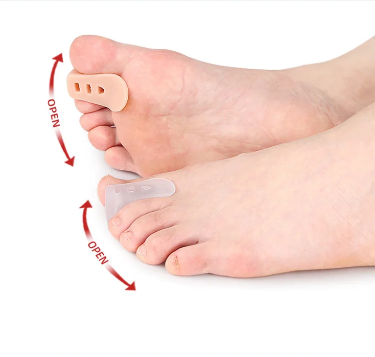 1/5/10Pair Gel Toe Orthosis Clip Pads Big Foot Bone Care Tools Splitter Thumb Hallux Valgus Bunion Corrector Overlap Separators