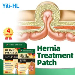 Hernia Remover Medicine Umbilical Inguinal Tumor Treatment Patch Colic Relief Femoral Abdominal Wall Repair German Secret Recipe