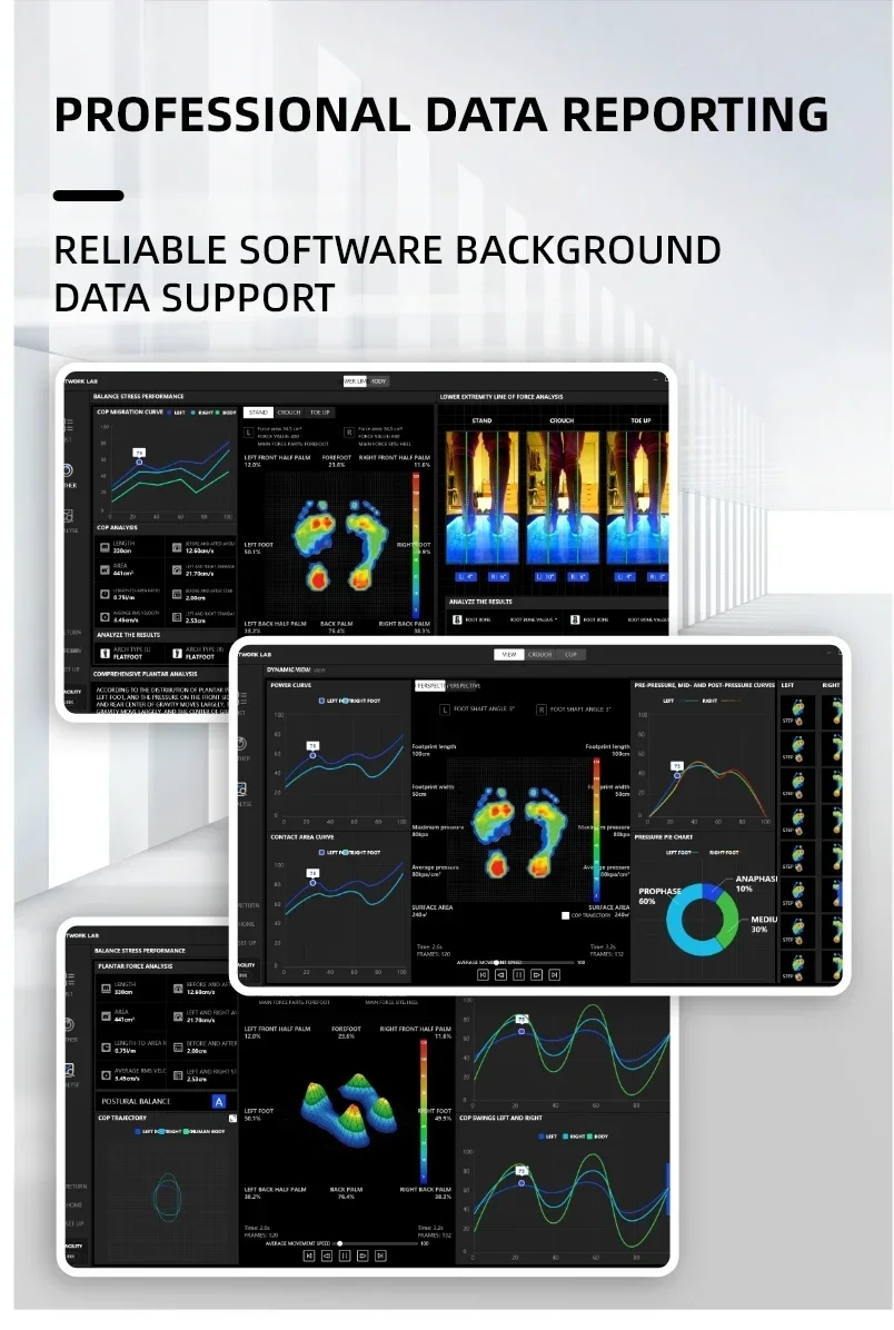 เครื่องวิเคราะห์แรงกดเท้า 3 มิติ F Move Pro Podoscope สำหรับการวิเคราะห์เท้าผู้มีภาวะเท้าแบน