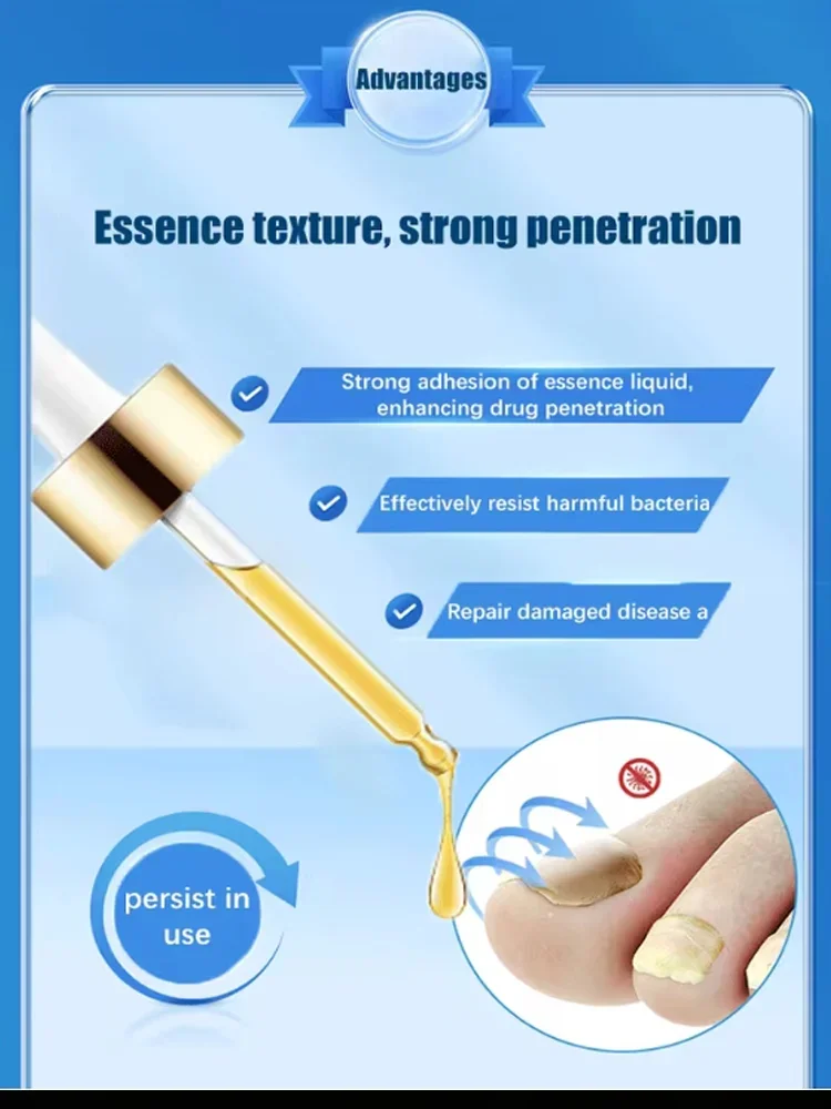 The fifth generation of champagne-colored nail laser pen helps remove nail fungus, colorless and long-lasting sterilization