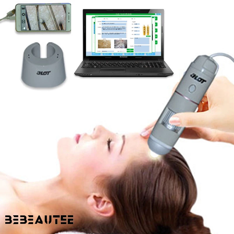 Portátil 720p digital wifi sem fio microscópio pele couro cabeludo analisador de cabelo facial pele cabelo couro cabeludo poros lupa