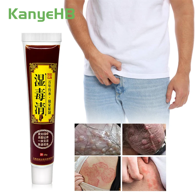 1pcs Scrotum Private Part Psoriasis Eczema Cream Anti-itch Anti-inflammatory Antifungal Cream Psoriasis Ointment Jock Itch S026