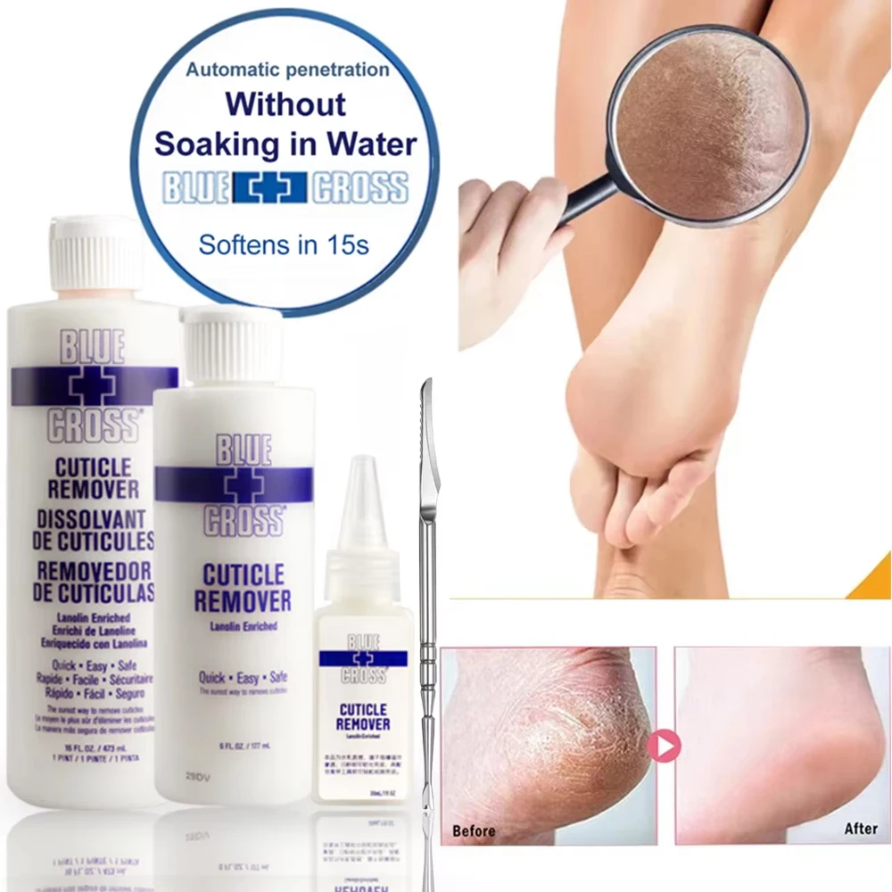 Foot Exfoliation Softener Exfoliation Foots Cuticle Remove Foot Mask Pedicure Nail Enhancer Remove Dead Skin Callus