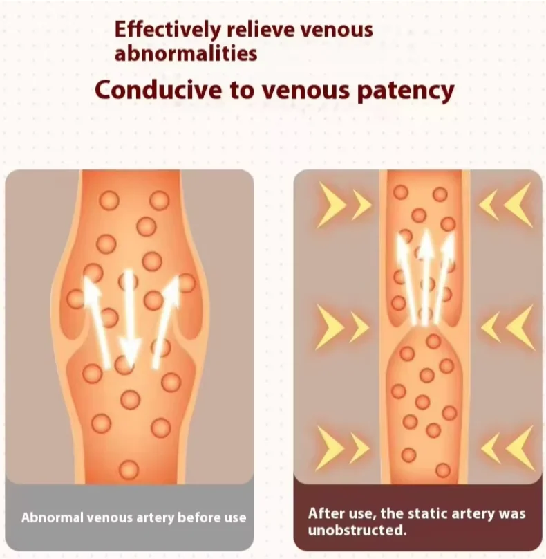 Thumbnail 3 - #18 Best Air Compression Leg Massagers to Buy In 2026