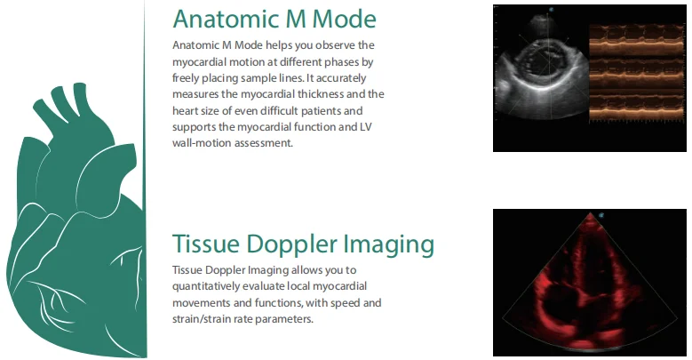 Máquina do ultrassom do doppler da cor do Sonoscape-P50 e P20, com tecnologia 4D diagnóstica, produto novo, acesso a