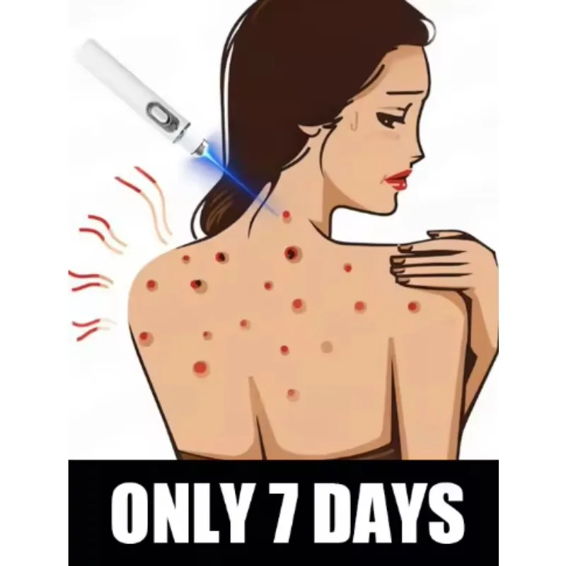 

Лазерная терапия 2025 HT, шрам Keloid, улучшение шрамов Keloid, ручка для облегчения шрамов, легкая безвредная лазерная указка