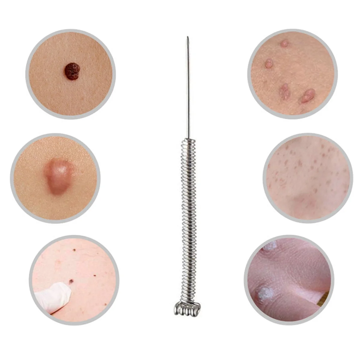 100 Pcs Mini Mole Removal Pen Needles for Sweep Spot Mole Freckle Plasma Point Pen Machine Beauty Equipment