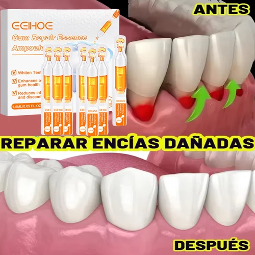 Ampollas de tratamiento de reparación de encías, esencia de cuidado bucal, limpieza de dolor de muelas, hinchazón de encías, elimina el aliento líquido, alivio de las encías T5y6