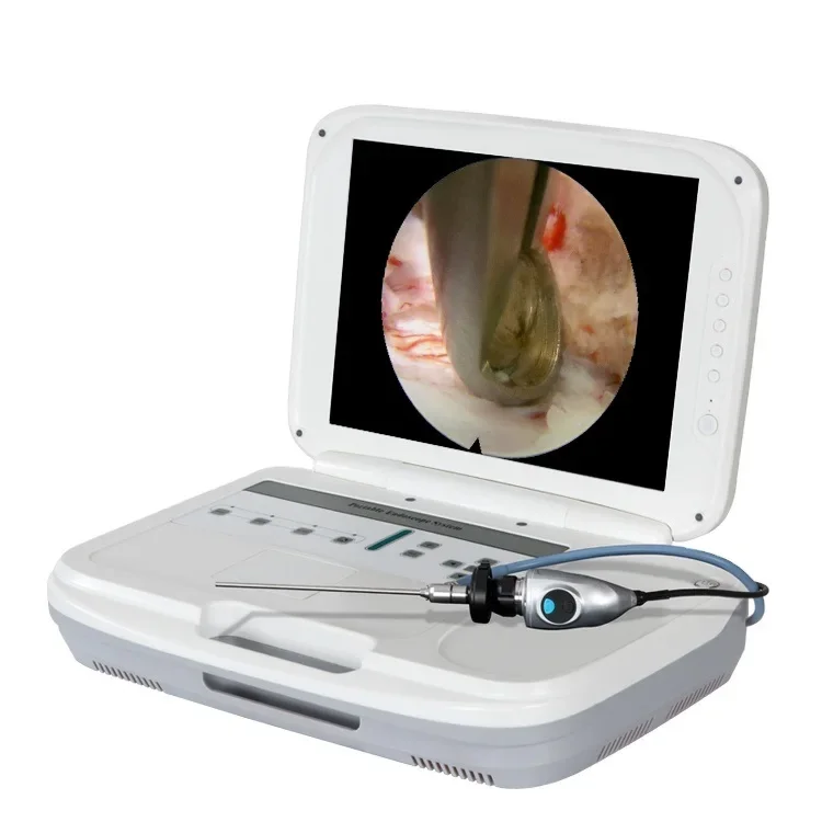 Arthroscopy Endoscopic Camera Full HD Portable Endoscopy Image System for 4mm Arthroscope