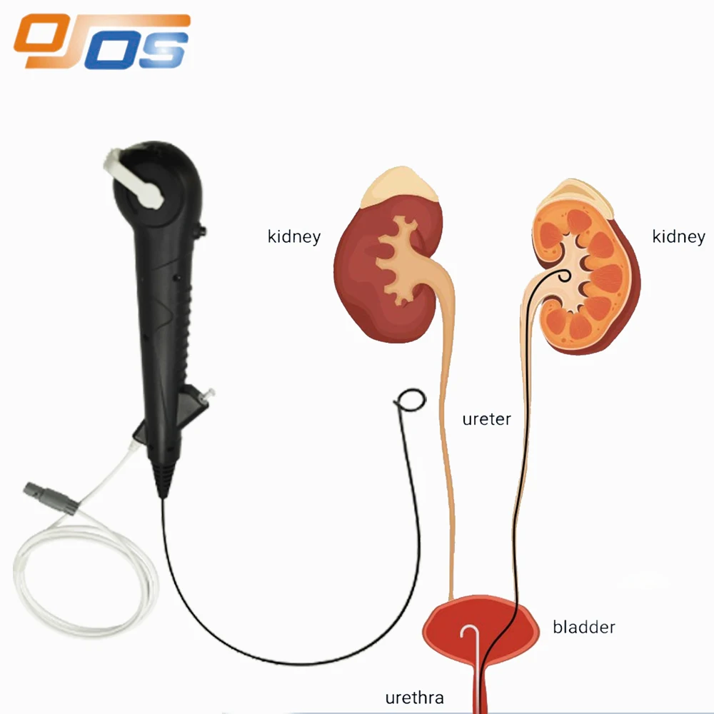 CRW USB Medical Ureteroscope Flexible     2.75mm 2.85mm 3.0mm  400X400P  Factory OEM