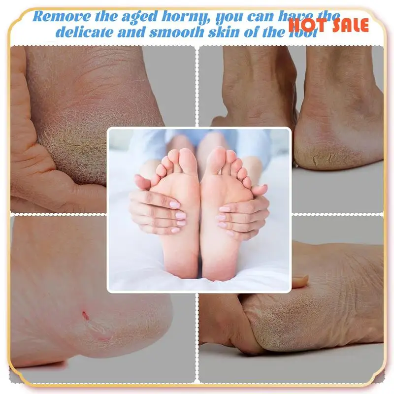 ABFA 1Pcs Professional Double Side Foot File Rasp Heel Grater Hard Dead Skin Callus Remover Pedicure File Foot Grater