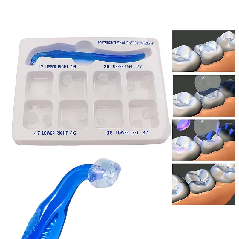 Dental Posterior Aesthetic Printing Mould Kit Light Cure Composite Filling Tools Oral Impression Forming Mold Dentistry Set