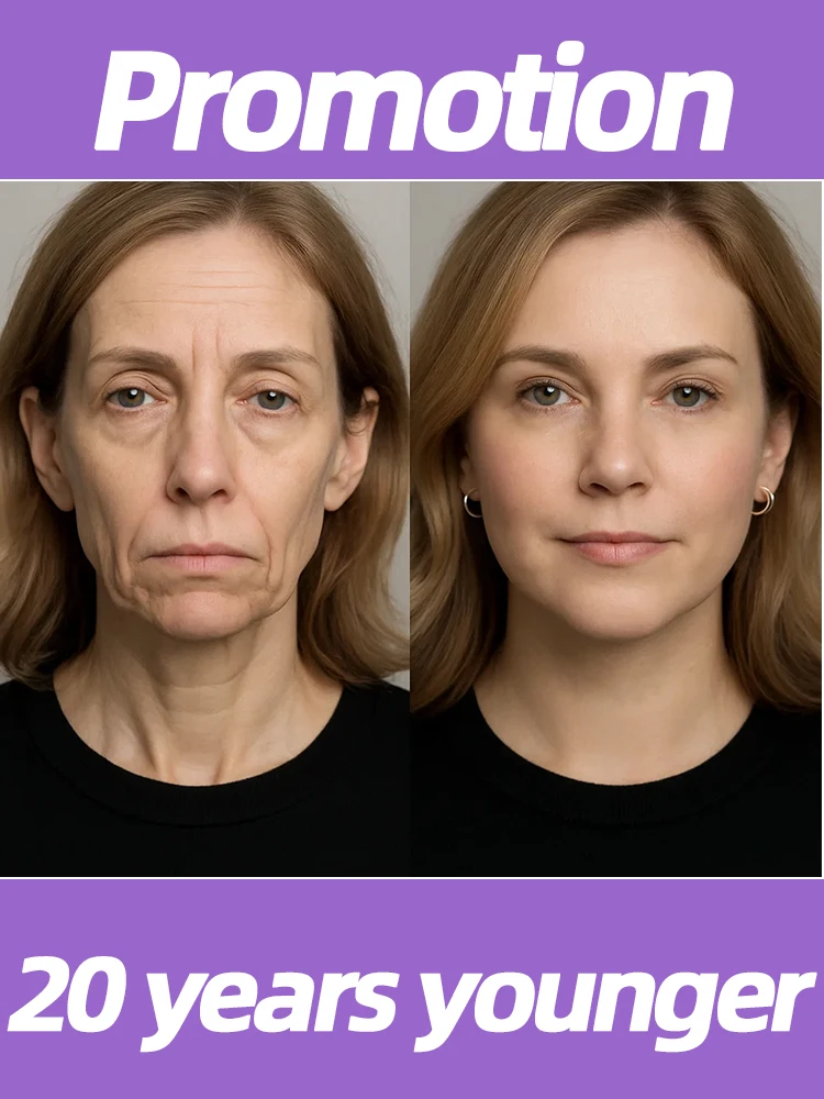 

20 years younger, 100% wrinkles disappear