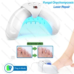 Nail Fungus Laser Device Toenail Laser Therapy Machine Anti Fungal Laser Equipment for Onychomycosis 910nm 407nm