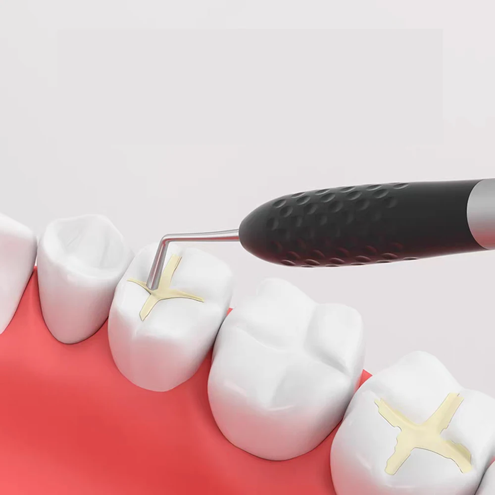 Dental Resin Filling Beauty Repair Tools Silicone Handle Resin Knife Plastic Dressings Dentistry Tools Instruments