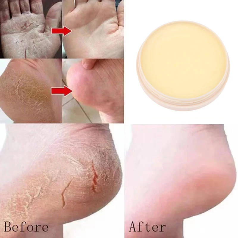Creme anti-secagem para pés, Óleo de reparo rachado no calcanhar, Remoção de pele morta Cuidado com os pés da mão