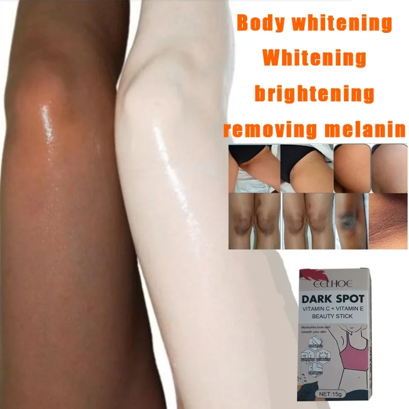 

Отбеливающая сыворотка для темных суставов пальцев, локтей, подмышек, пляжная сыворотка, женская интимная часть кожи, удаление темных суставов пальцев, сильная отбеливающая сыворотка