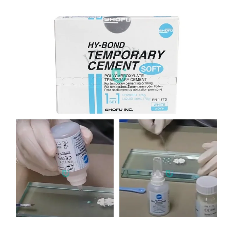 SHOFU Polycarboxylate Based Temporary Cement for Provisional Crowns, Fixed Restoration and Implant Prosthesis Temporary Cement