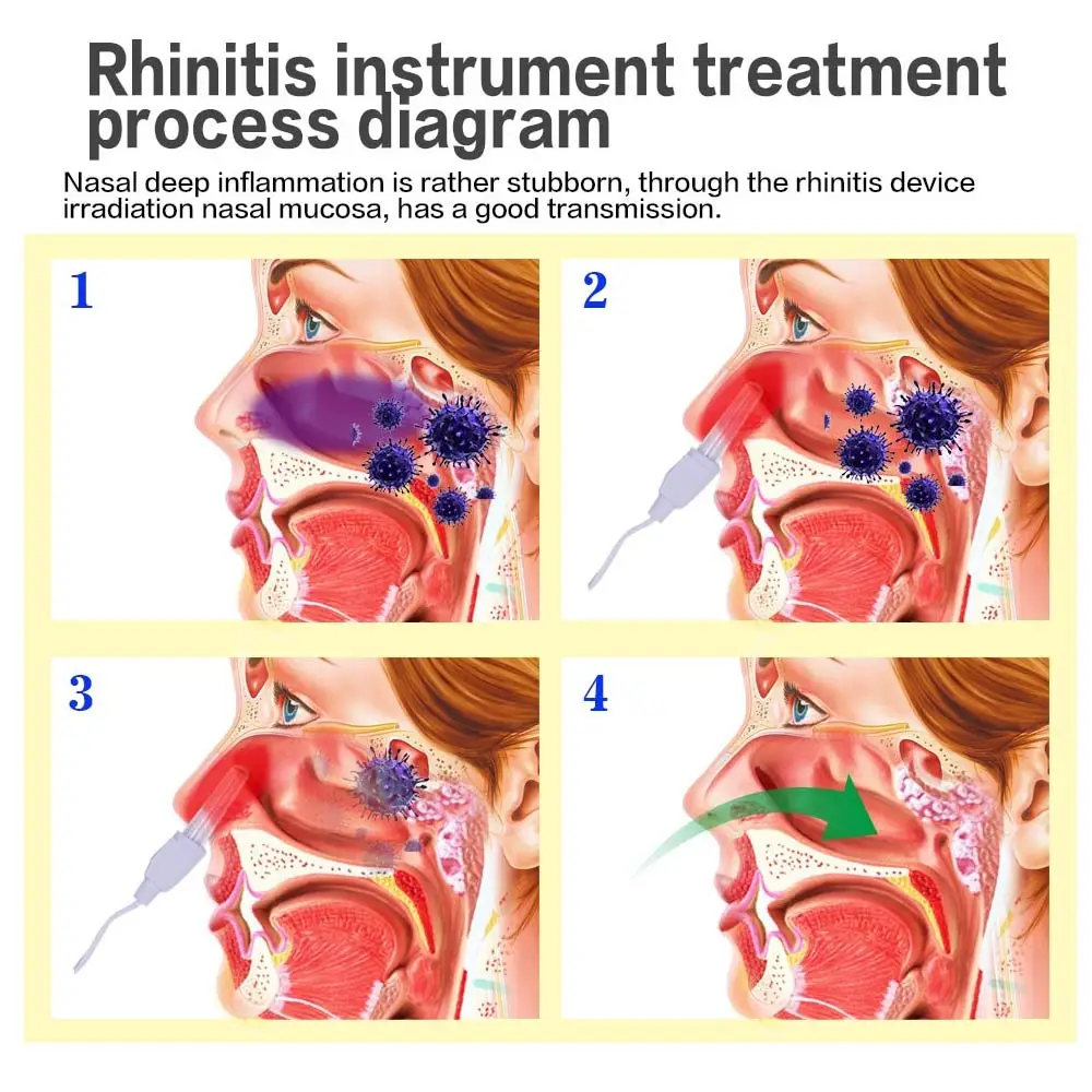 Dropshipping Rhinitis Sinusitis Cure Therapy Machine Nose Care Rhinitis BioNase Massage Device Laser Treatment Health Care Tool