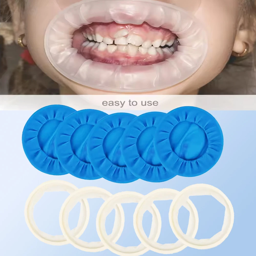 

5pcs Dental Rubber Mouth Opener Blue Soft Sterile O Shape Disposable Cheek Expander for Oral Procedures Rubber Dam Support