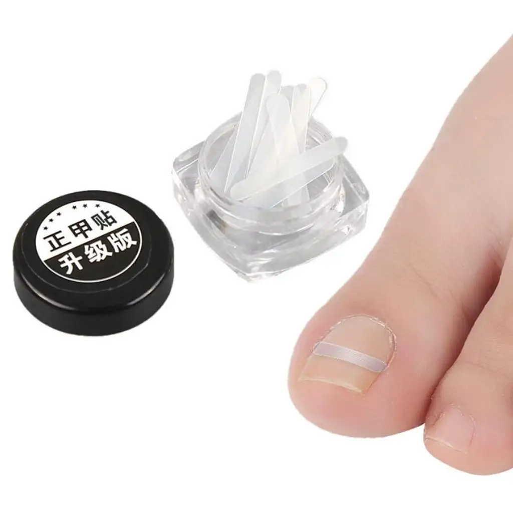 Autocollants pour traitement des ongles incarnés, patch élastique, outils de pédicure, 10 pièces