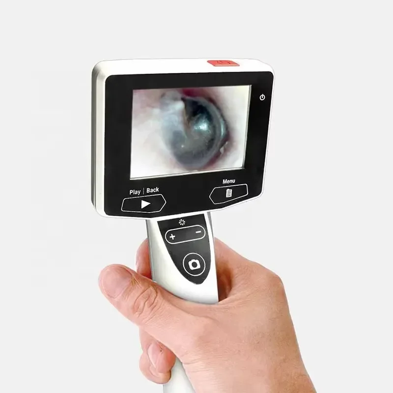 2022 ENT Unit Video Otoscope with HD LCD Screen Ear Examination Instrument