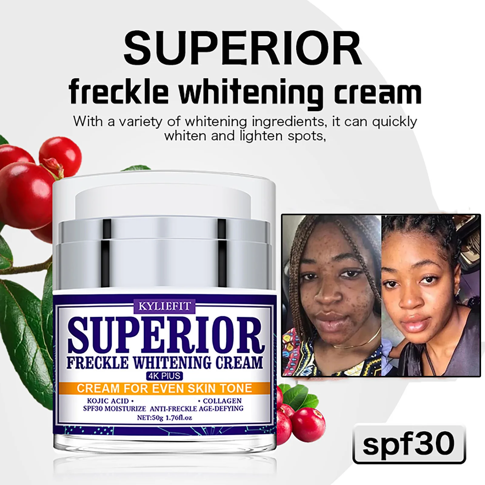 KYLIEFIT Superior Freckles Whitening Women Face Cream, Dark Spot Correction Facial Cream, Remove Stains, Age Spots, Sun Spots