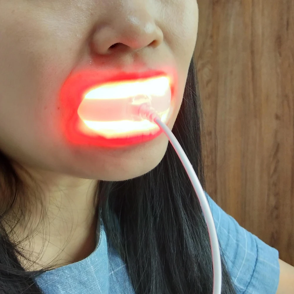 Cold Sore Red LED Light Therapy Device for Canker Sore Lip Herpes Oral Ulcers Teeth Soreness 4 in 1 Jacks Dental Care Tool