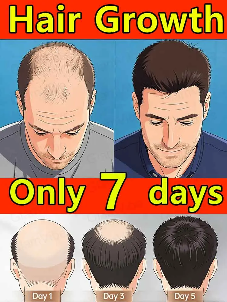 Stärken Sie die Haarwurzeln, um das Haar fest zu fixieren und dichtes, voluminöses Haar zu erzeugen.