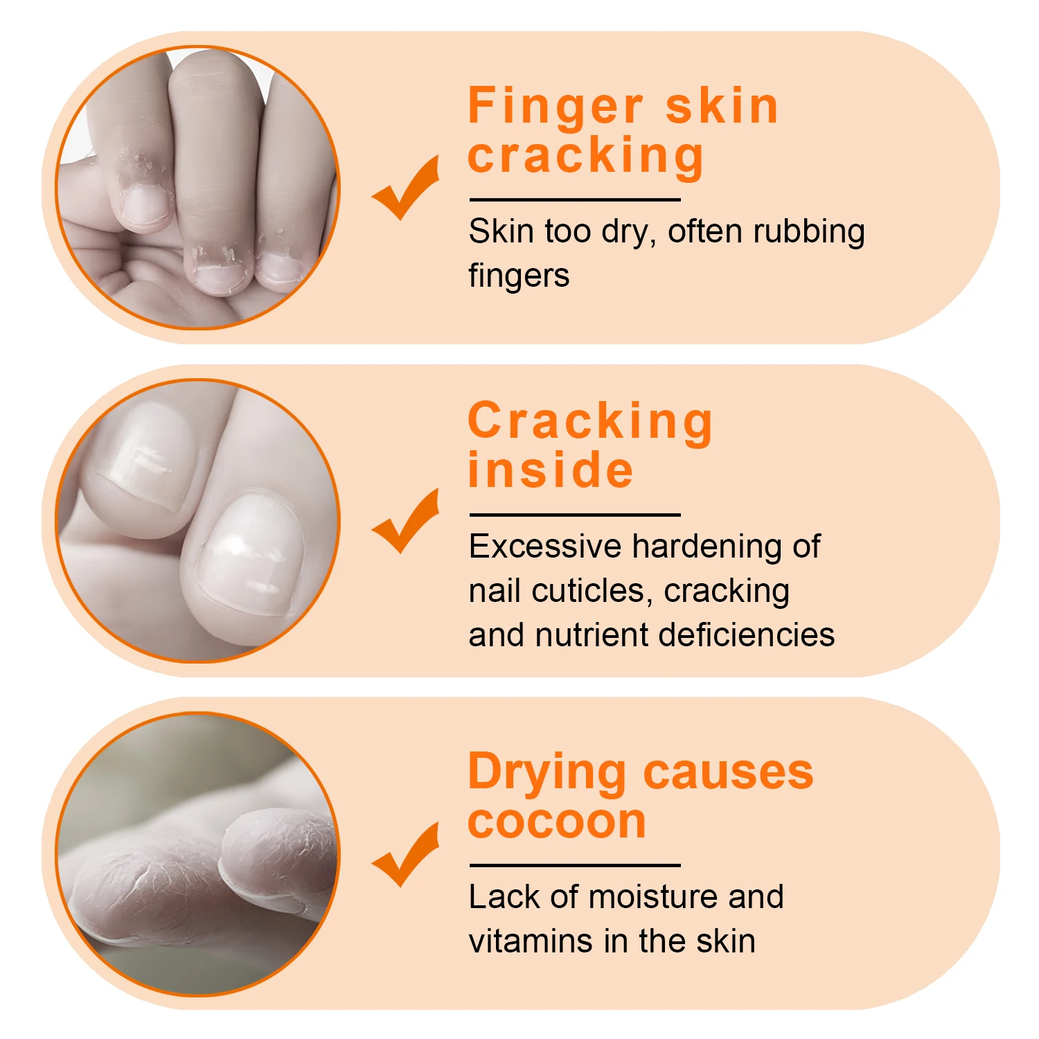 TWOING Vitamin E Nail Care Oils，Nail Cuticle Hydration & Nail Strengthening, Deeply Moisturizing for Healthier,Shinier,Nails 8ML