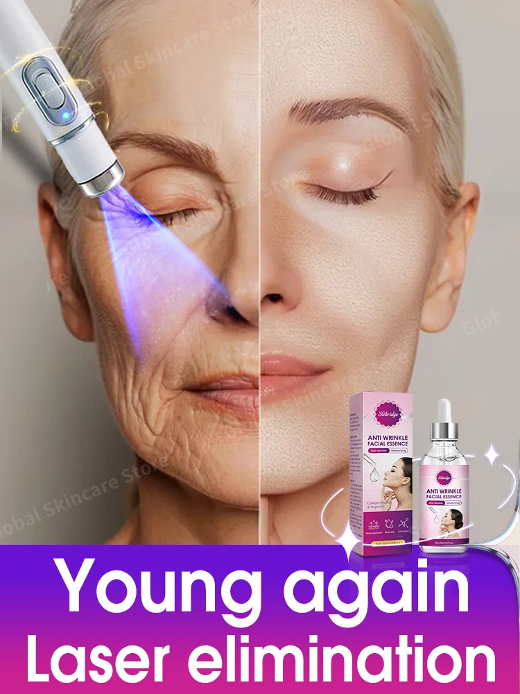 

Laser Product For Solves wrinkle Problems