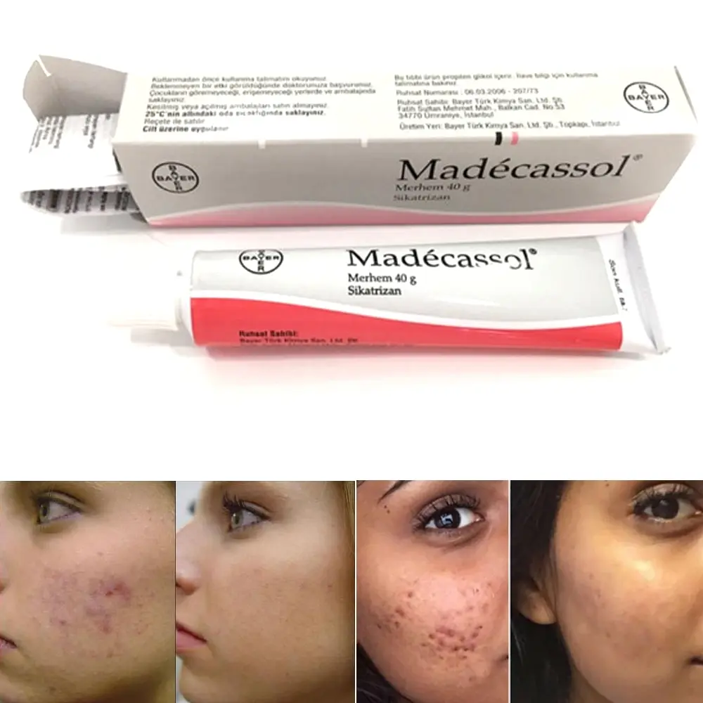 Madecassol-Crema de efecto mágico, bálsamo de Sikatrizan, Centella, regenerador de células asiáticas, acné, granos, lesión, dolor en la piel, rejuvenecimiento de la piel, 40 g