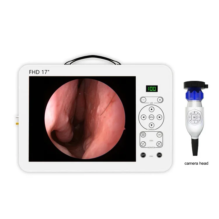 17 Inch HD Video Otoscope ENT Diagnostic System Set | High Definition Imaging for Otolaryngology Medical Examination