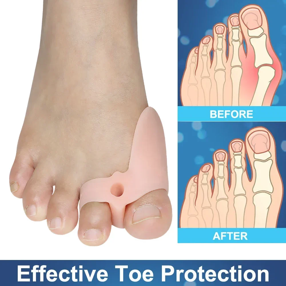 Pexmen 2Pcs/Pair Soft Bunion Corrector Toe Separators Spacers for Bunion Relief Bunion Cushion Protector with Gel Shield