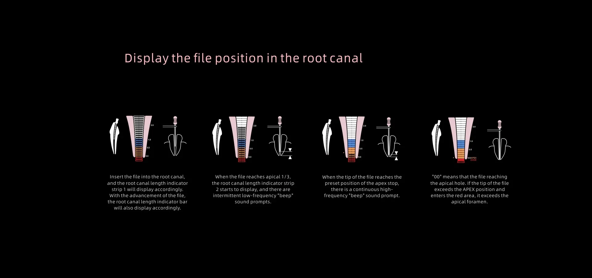 hot 2026  Woodpex V Dental Apex Locator Multi-Configuration Accurate Portable Endodontic Treatment Dental System Equipment view 4