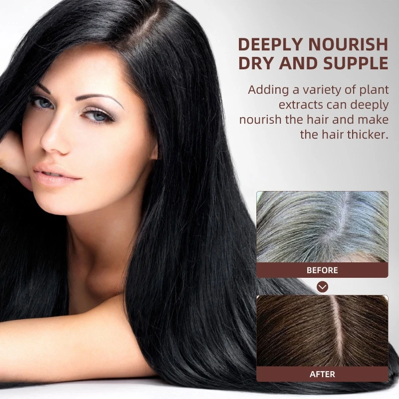 Xà phòng gội kiểm soát dầu Xà phòng gội đầu trắng đến đen Làm sạch sâu xà phòng gừng