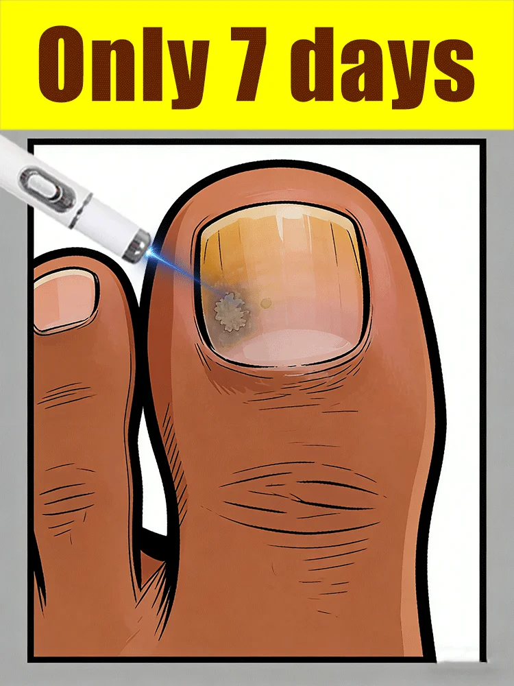 

laser pen A must-have blue light laser therapy device for families