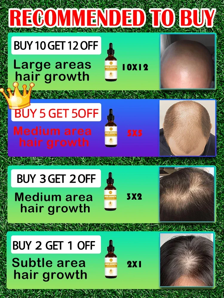 Essential oils that promote rapid hair growth and treat baldness and hair loss